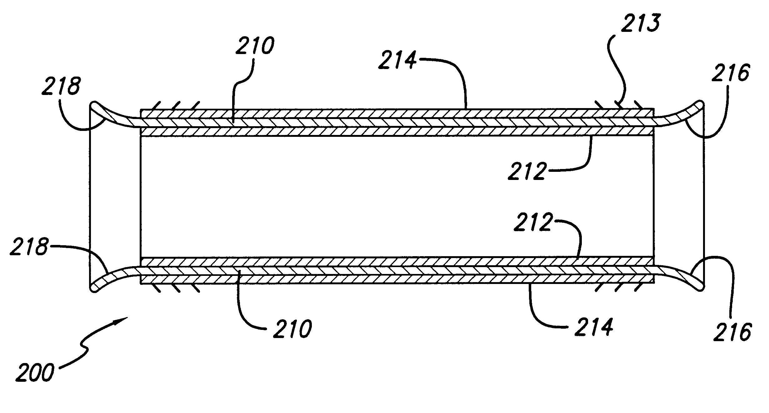 Encapsulated stent