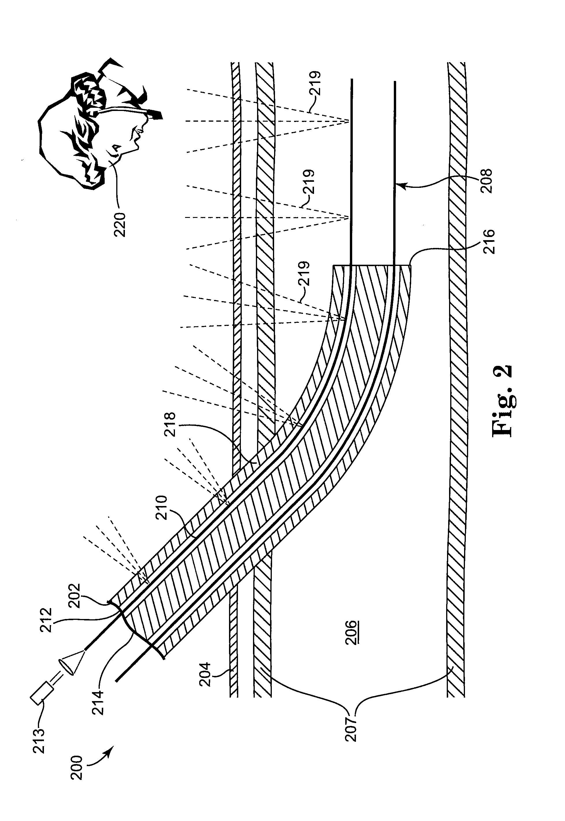 Light-guided transluminal catheter