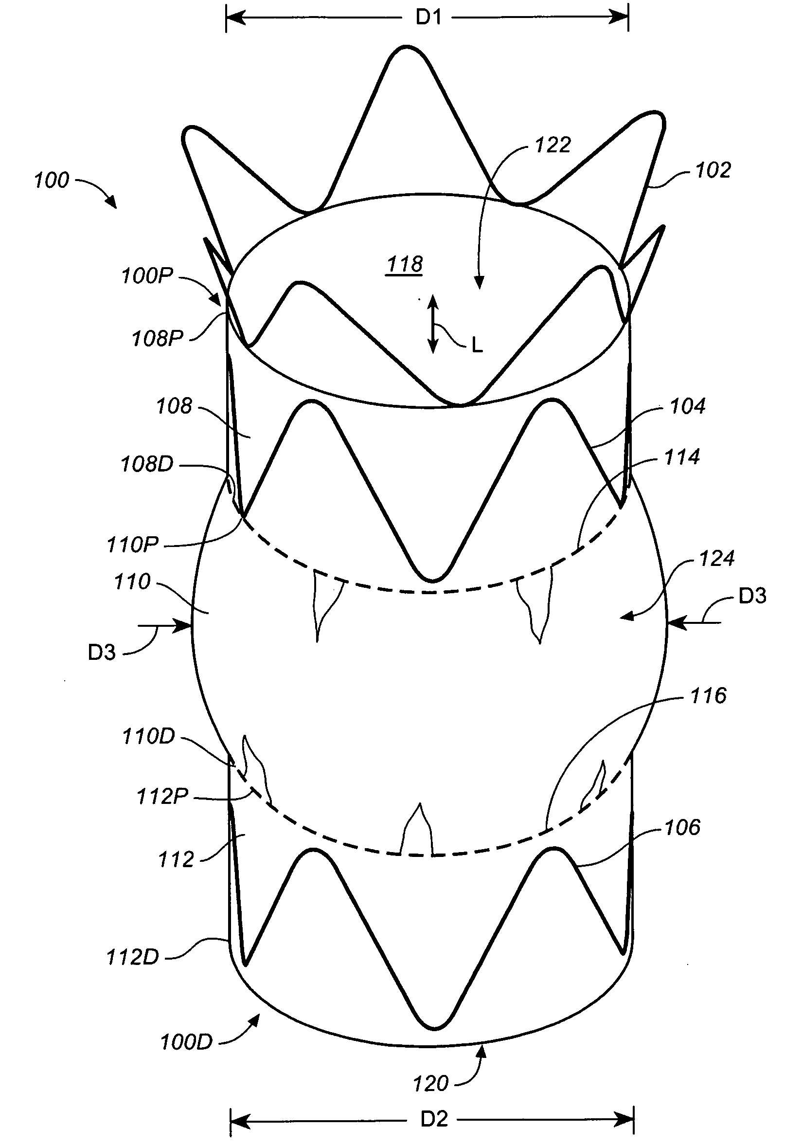 Bloused Stent-Graft and Fenestration Method