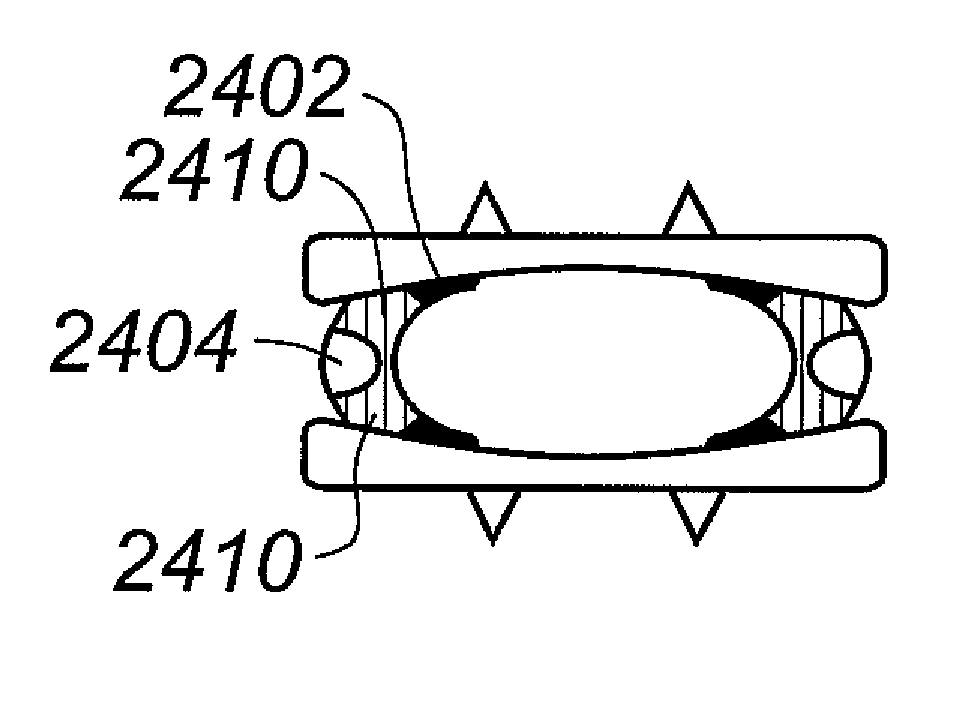 Artificial disc replacement (ADR) using elastic tether member