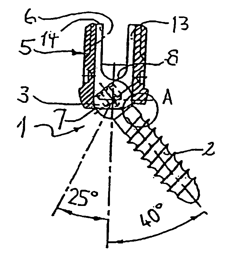 Bone screw