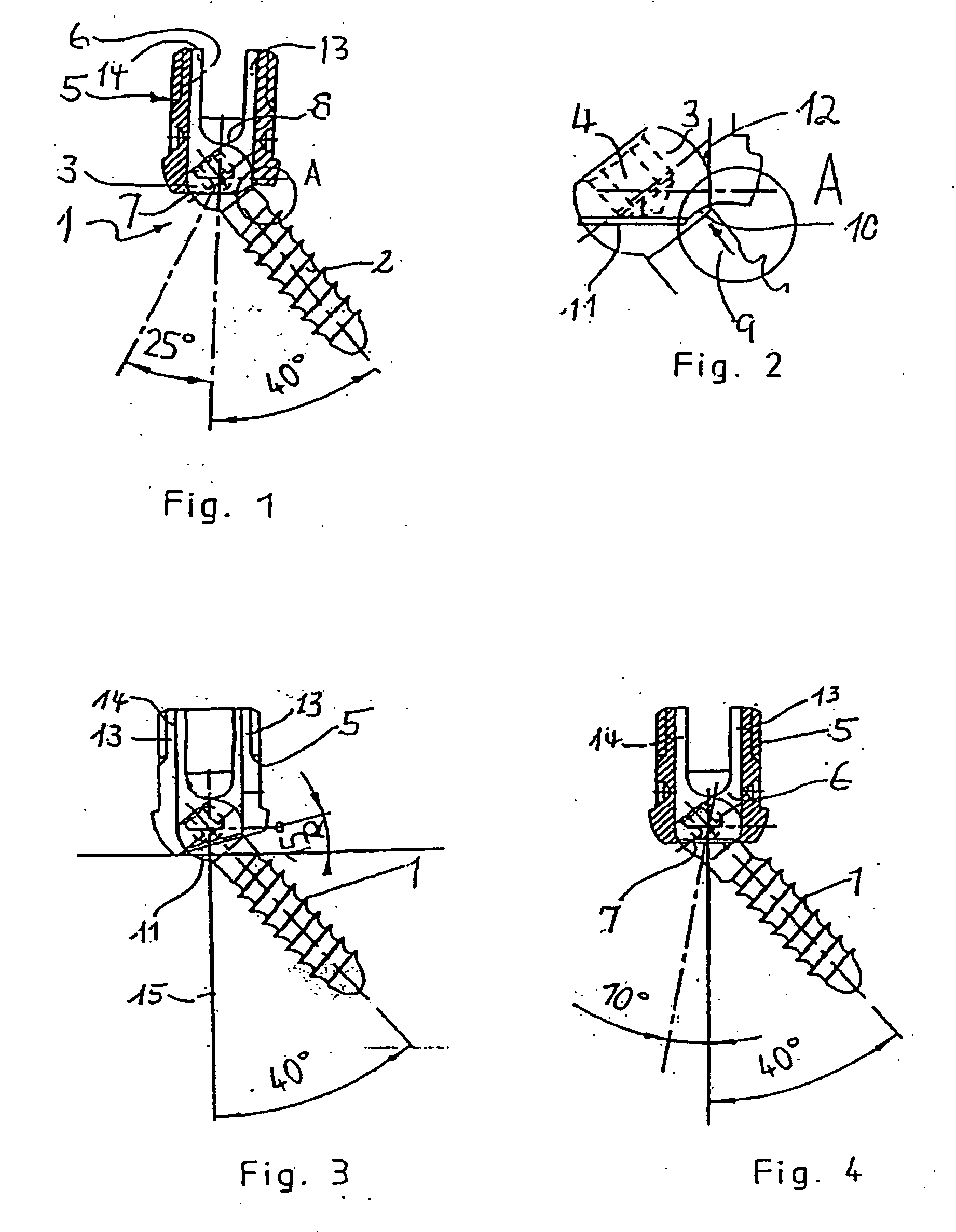 Bone screw