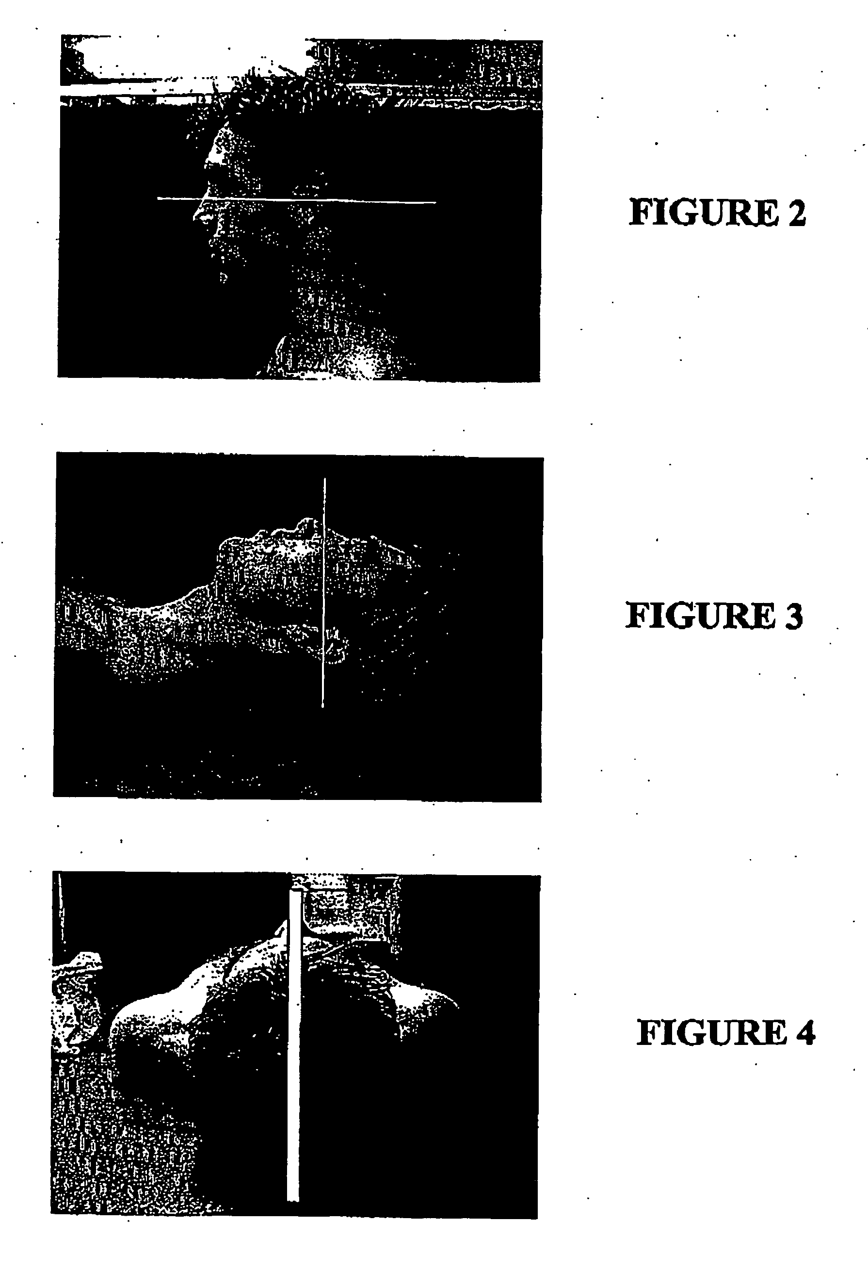 Assessment Apparatus and Method