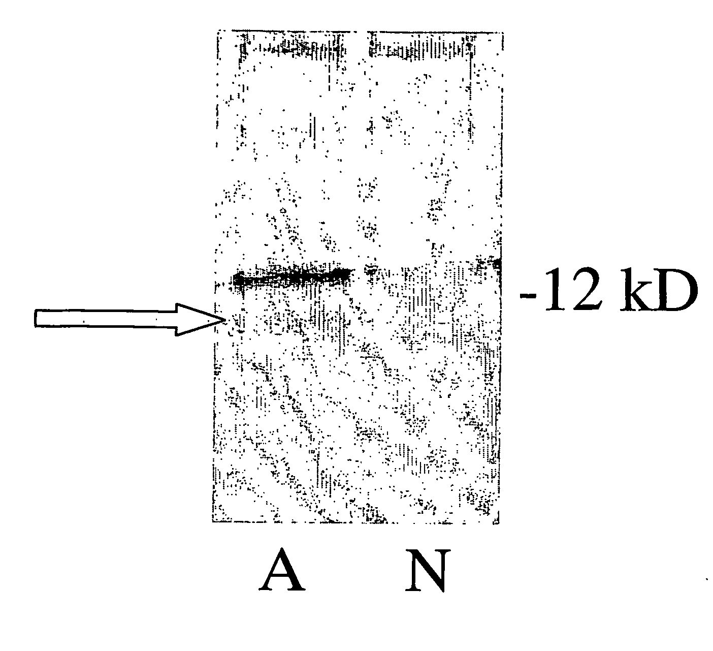 Methods for diagnosing htlv-i-mediated diseases