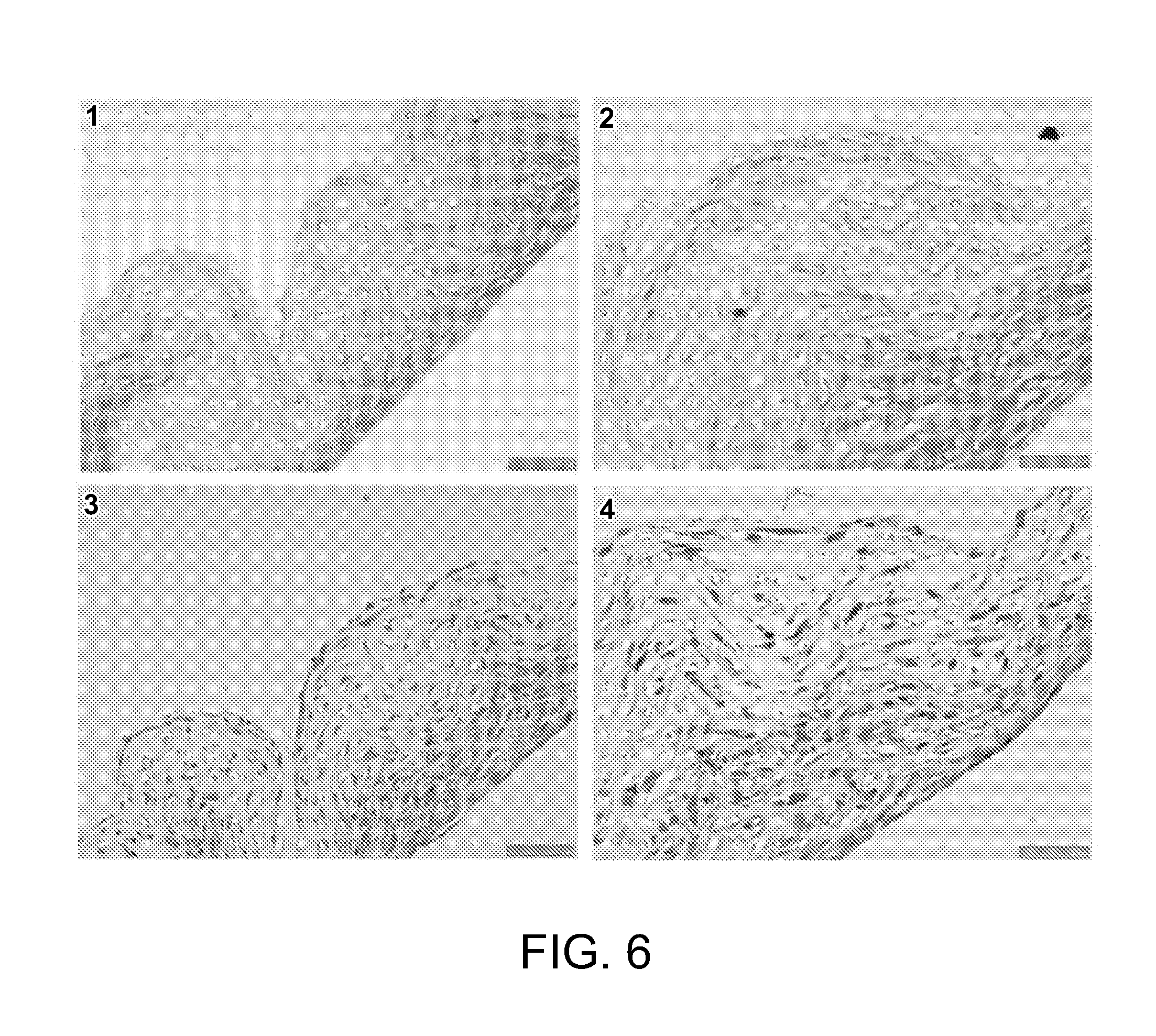 Cell-nanofiber composite and cell-nanofiber-hydrogel composite amalgam based engineered intervertebral disc