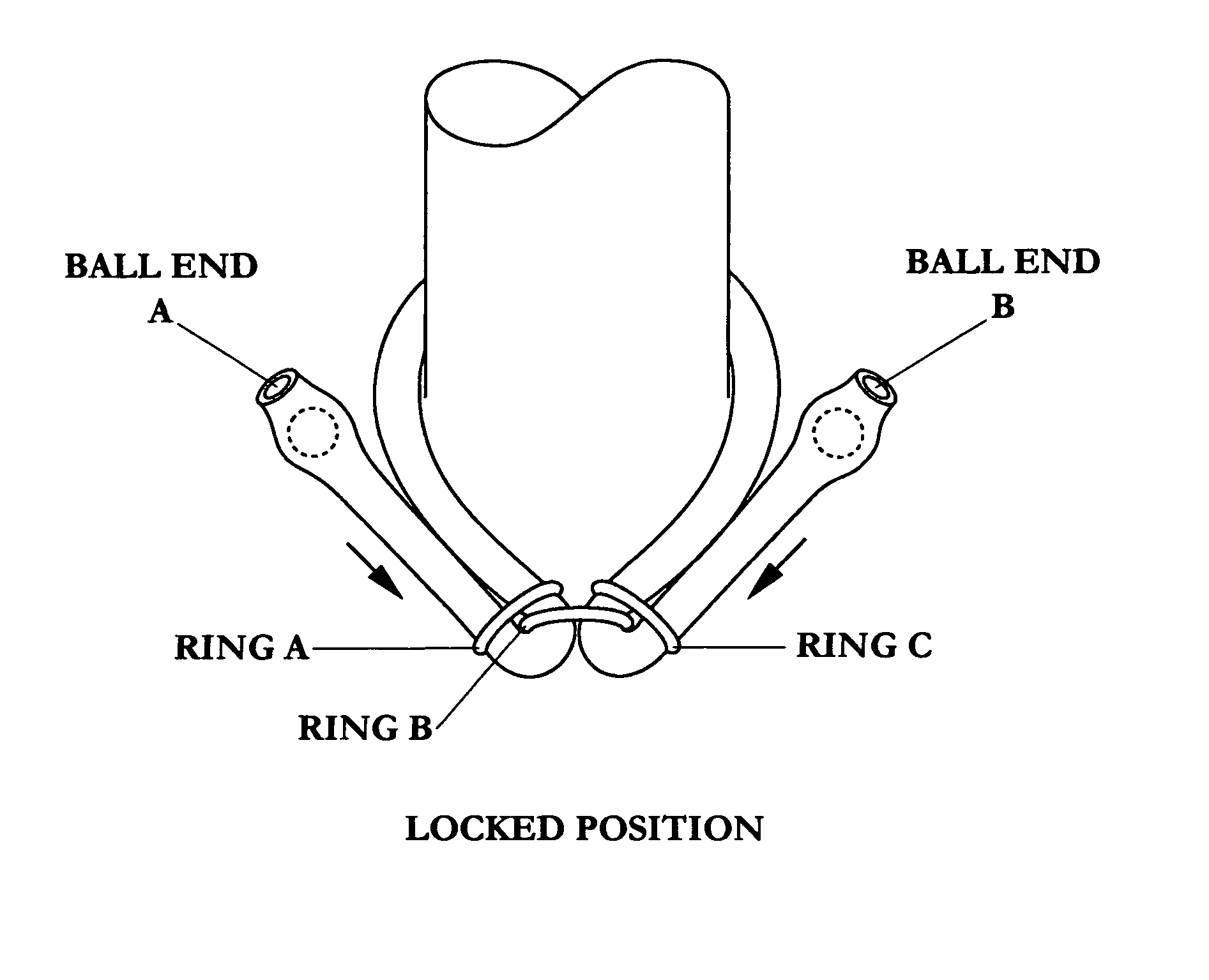 Adjustable tourniquet for venous flow control