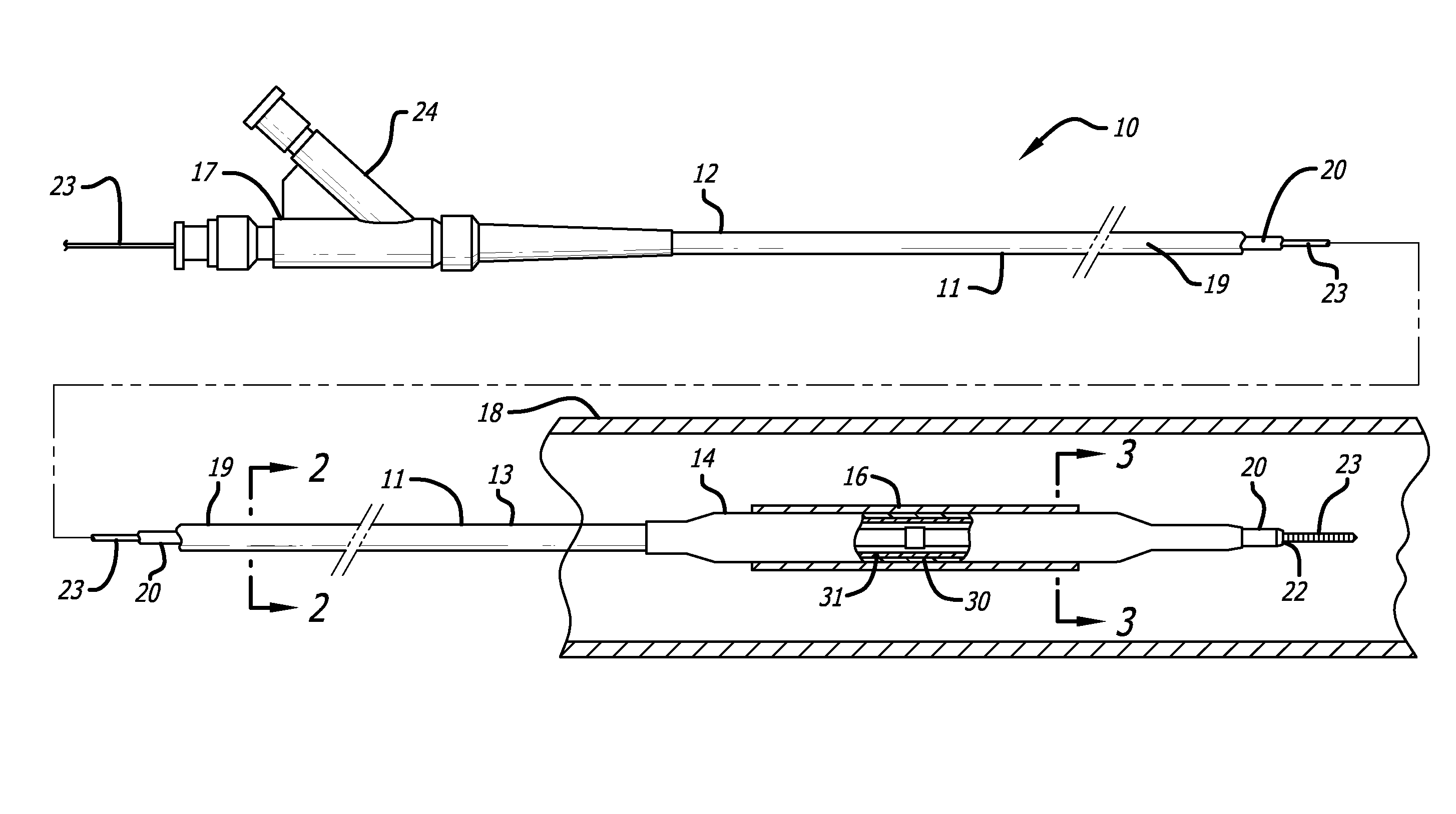 Catheter balloon and method for forming same