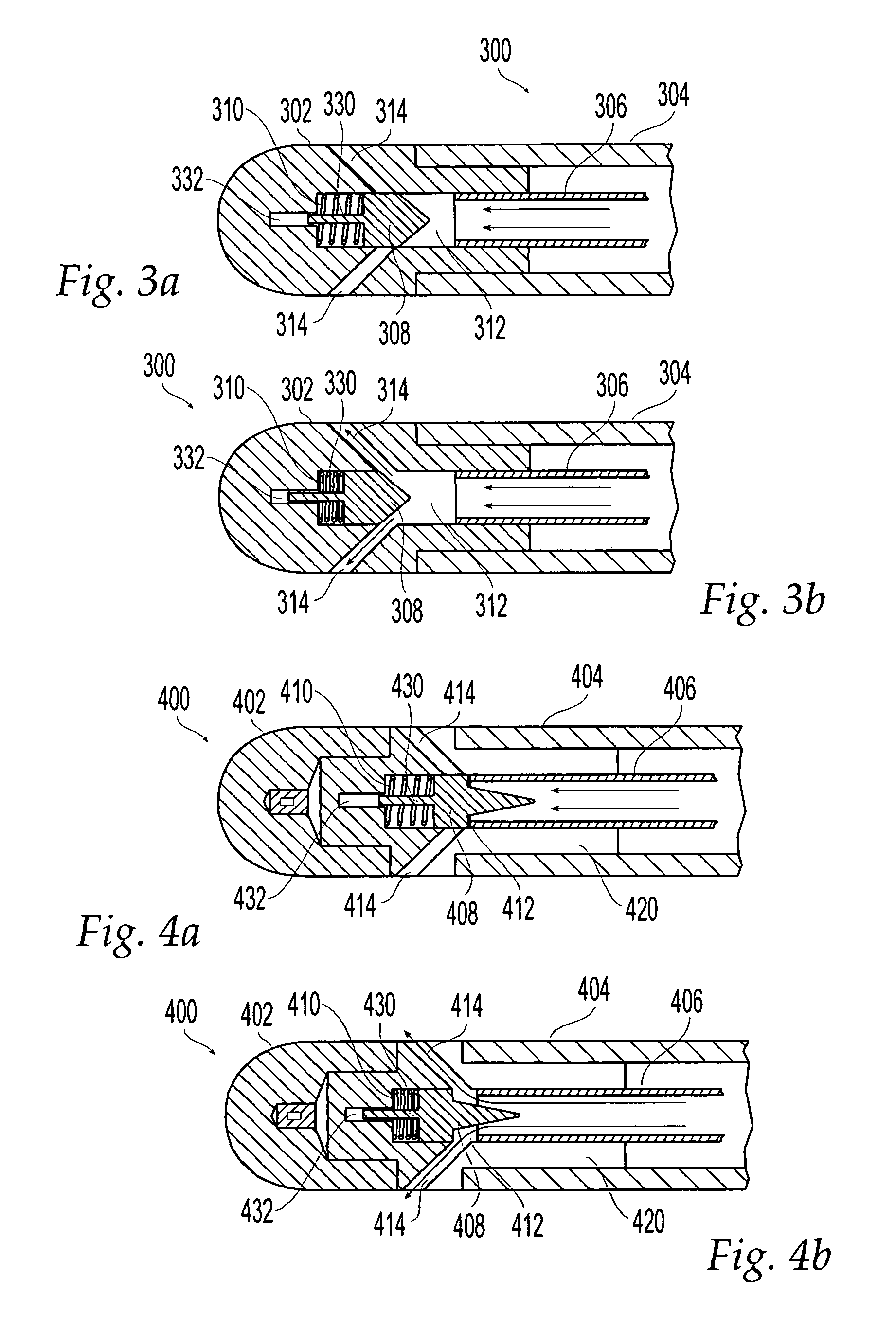 Irrigated ablation catheter having a valve to prevent backflow