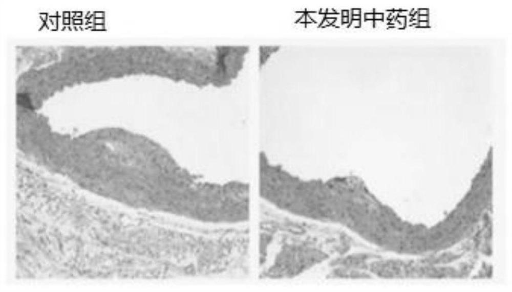 Traditional Chinese medicine composition as well as application and preparation thereof