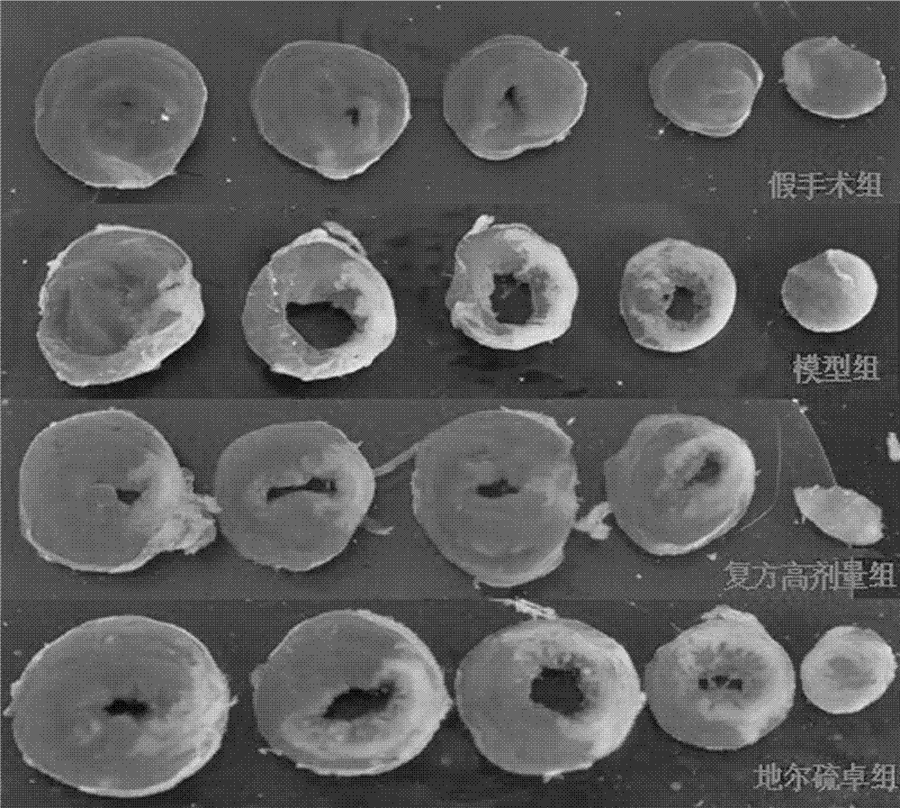 Chinese herba preparation for treating coronary heart disease and preparation method thereof