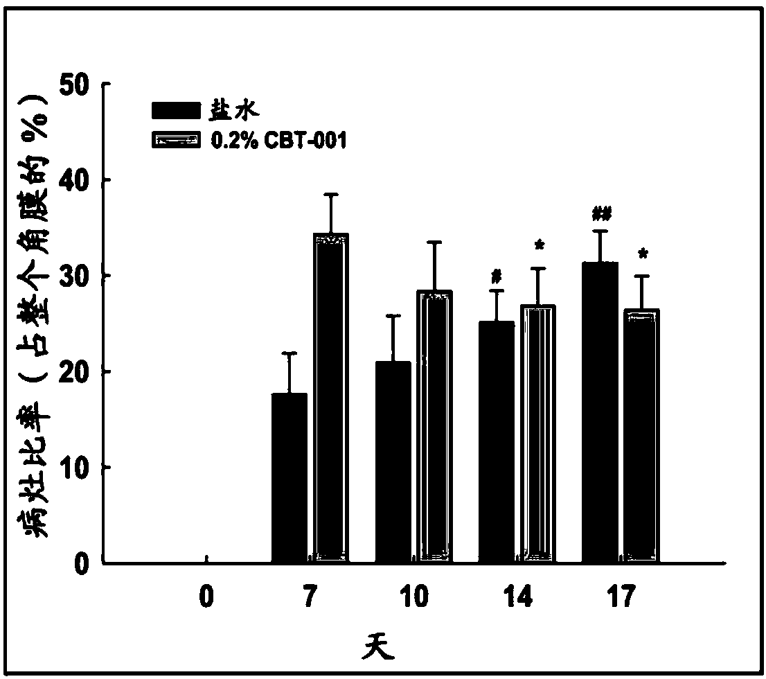 Compositions and methods for treating pterygium