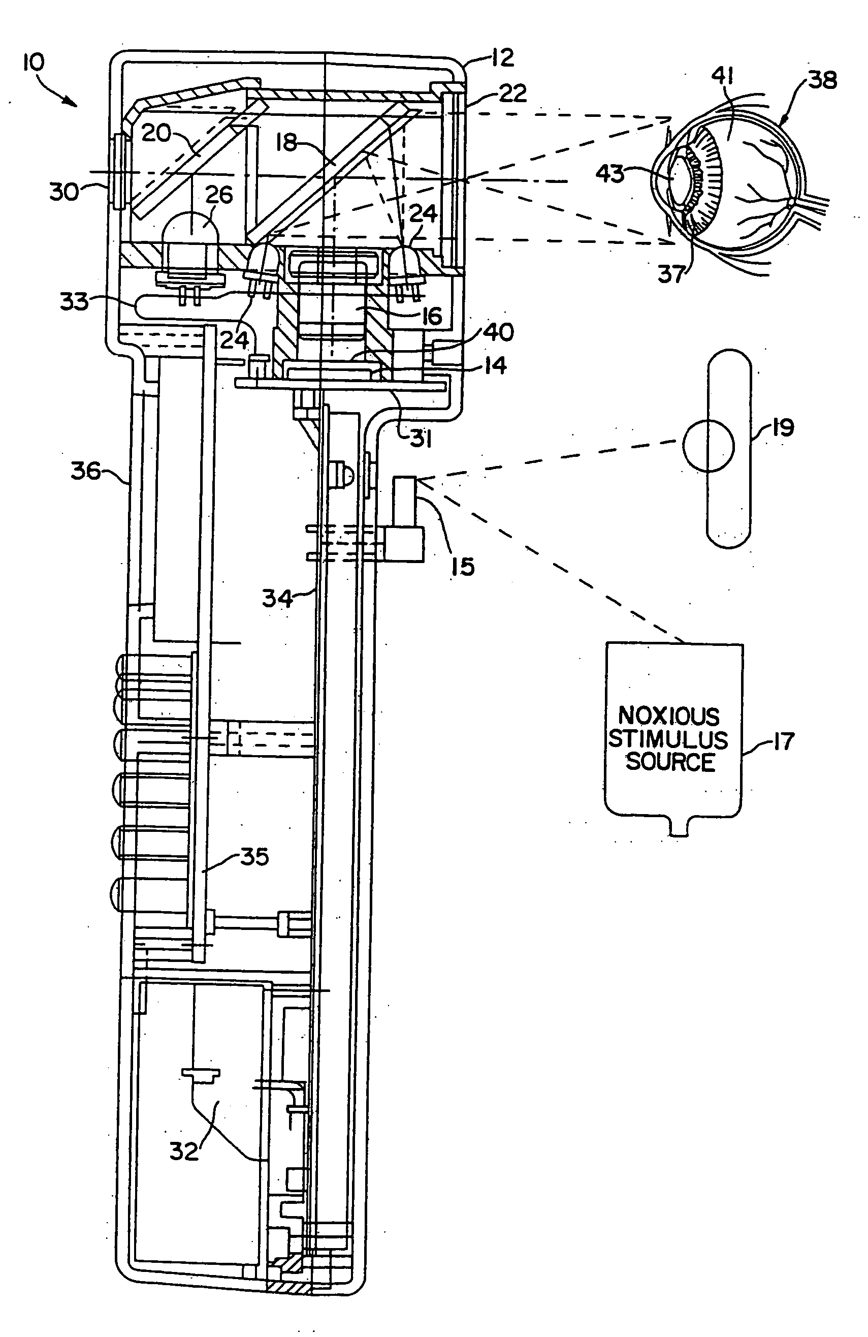 Pupilometer with pupil irregularity detection, pupil tracking, and pupil response detection capability, glaucoma screening capability, intracranial pressure detection capability, and ocular aberration measurement capability