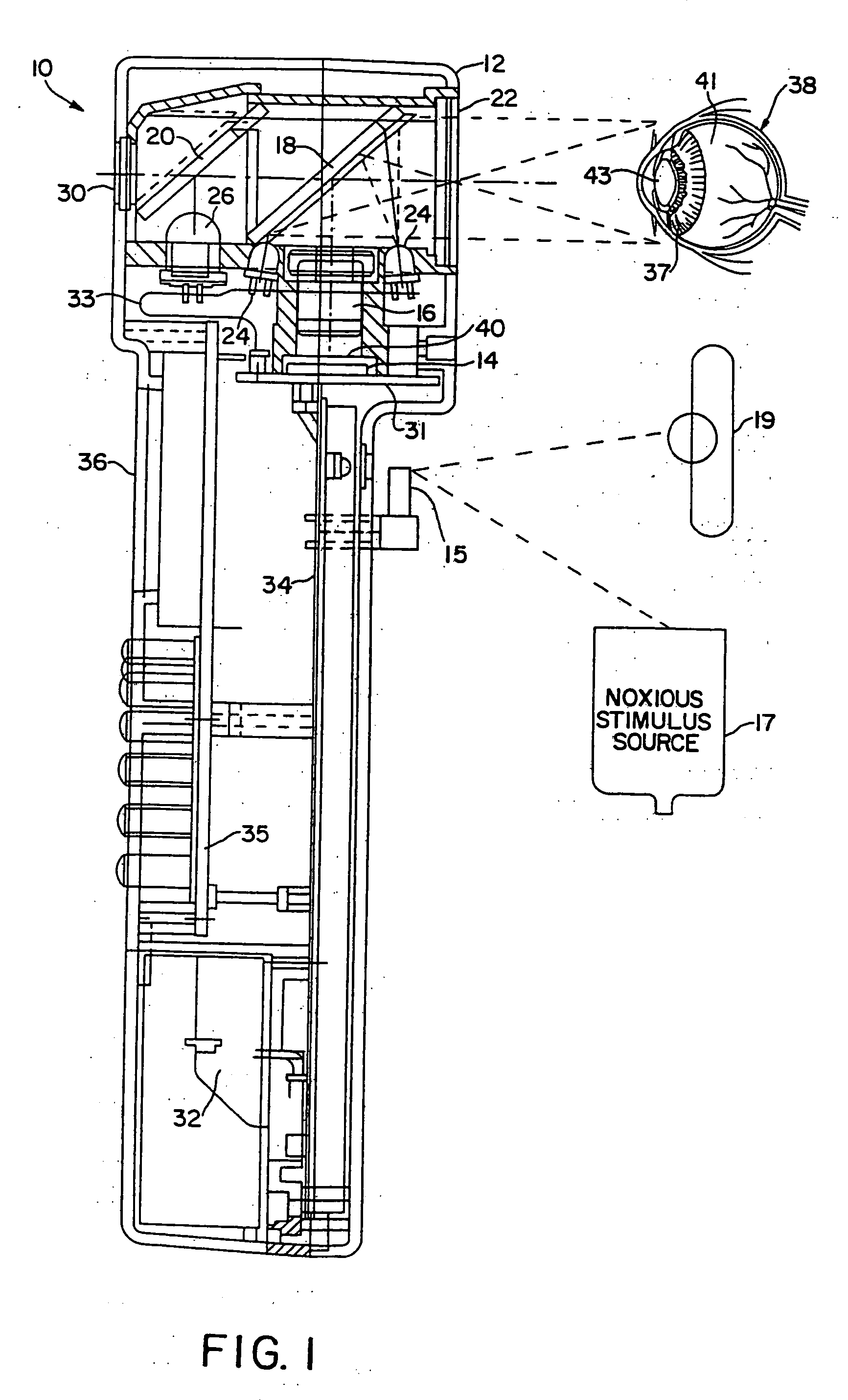 Pupilometer with pupil irregularity detection, pupil tracking, and pupil response detection capability, glaucoma screening capability, intracranial pressure detection capability, and ocular aberration measurement capability