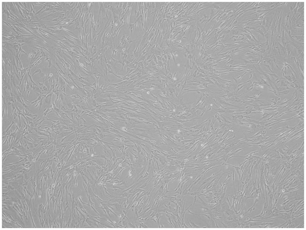 Cryopreservation liquid and cryopreservation method for stem cells and stem cell products