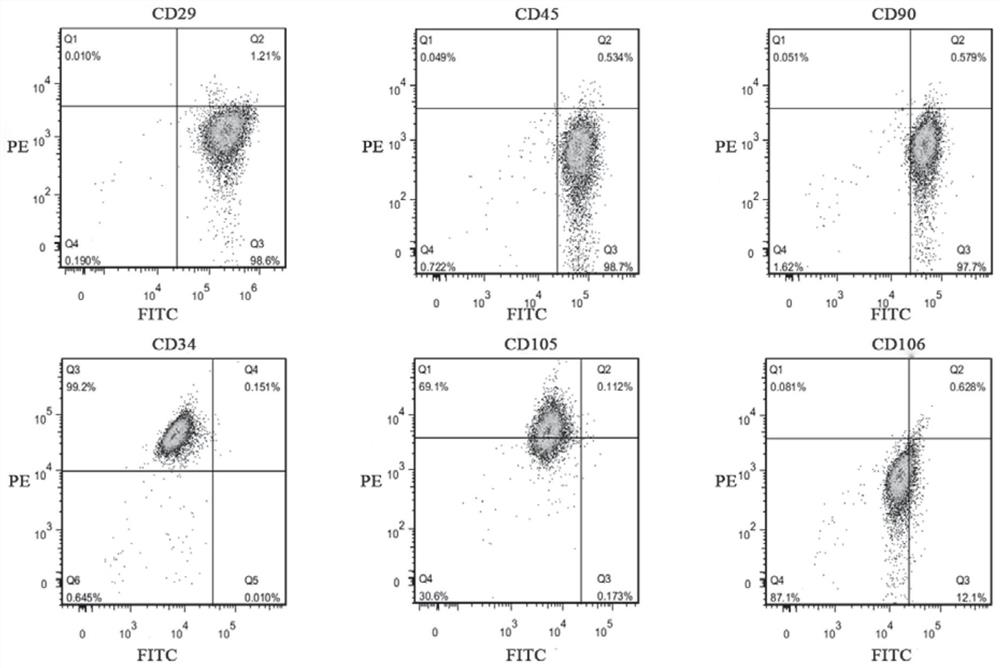 Intermittent hypoxia treatment of stem cell-derived exosomes and its application in myocardial tissue