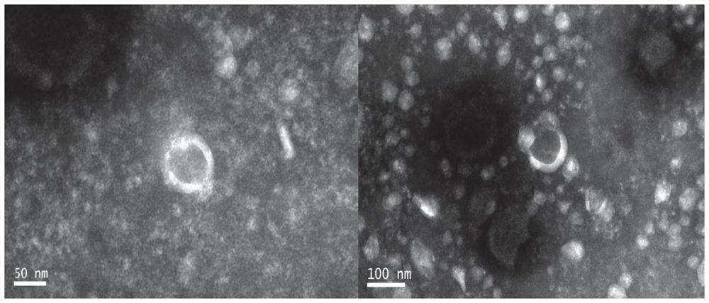 Intermittent hypoxia treatment of stem cell-derived exosomes and its application in myocardial tissue