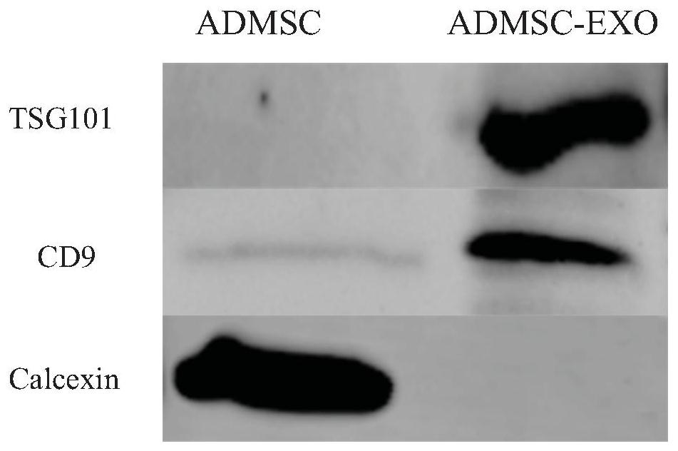 Intermittent hypoxia treatment of stem cell-derived exosomes and its application in myocardial tissue