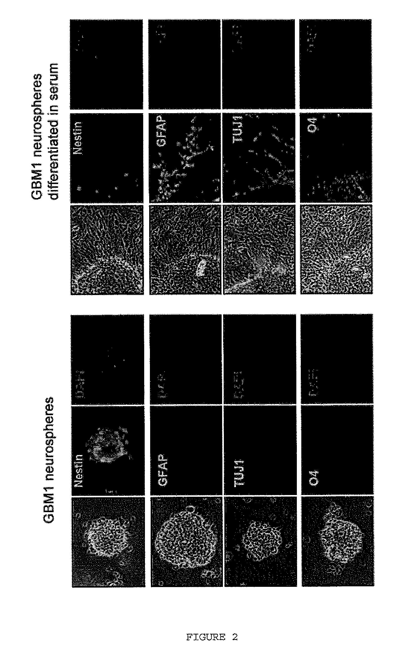 Therapeutic agents for the treatment of diseases associated with undesired cell proliferation