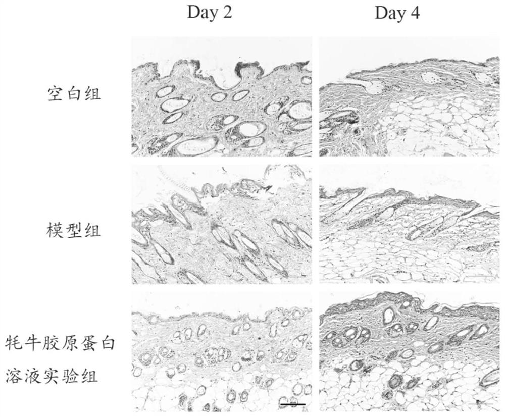 Yak type I collagen product for repairing light injury of skin