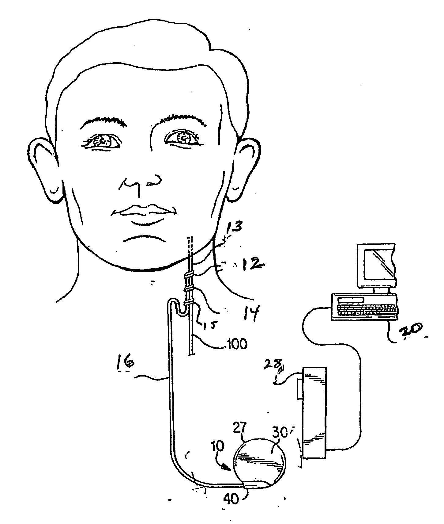 Trained and adaptive response in a neurostimulator