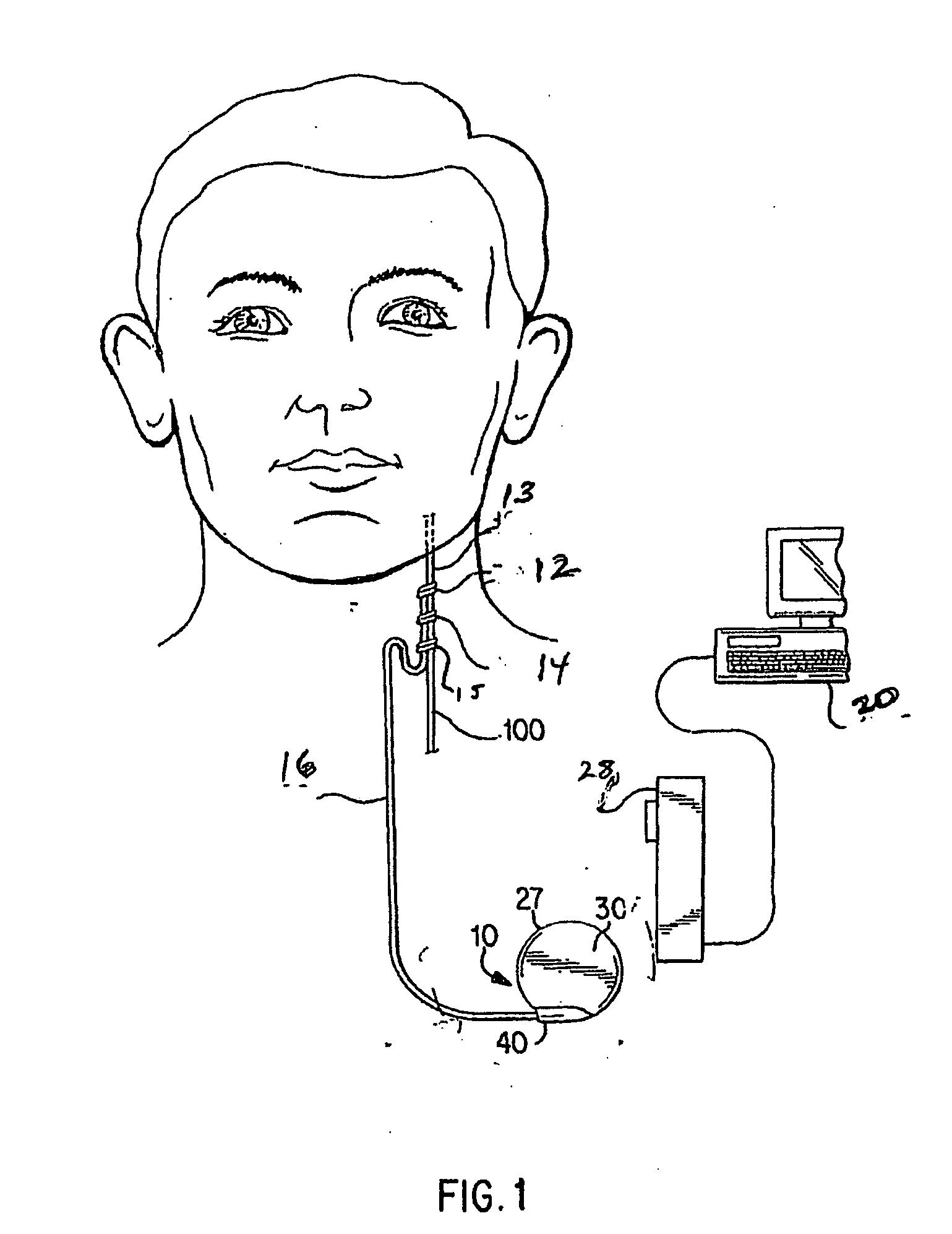 Trained and adaptive response in a neurostimulator