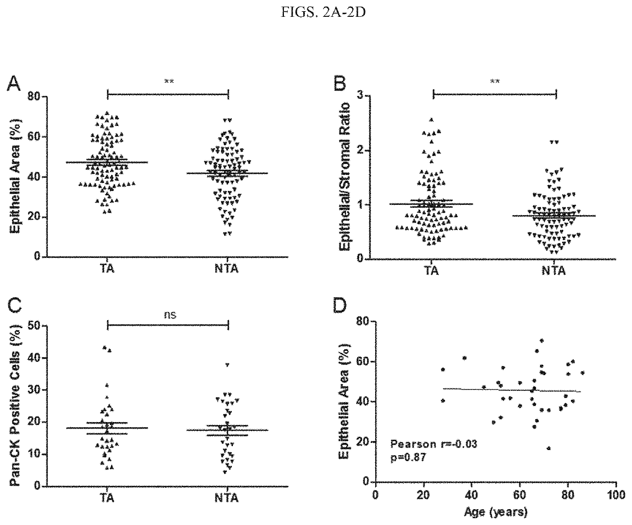 Image analysis of epithelial component of histologically normal prostate biopsies predicts the presence of cancer