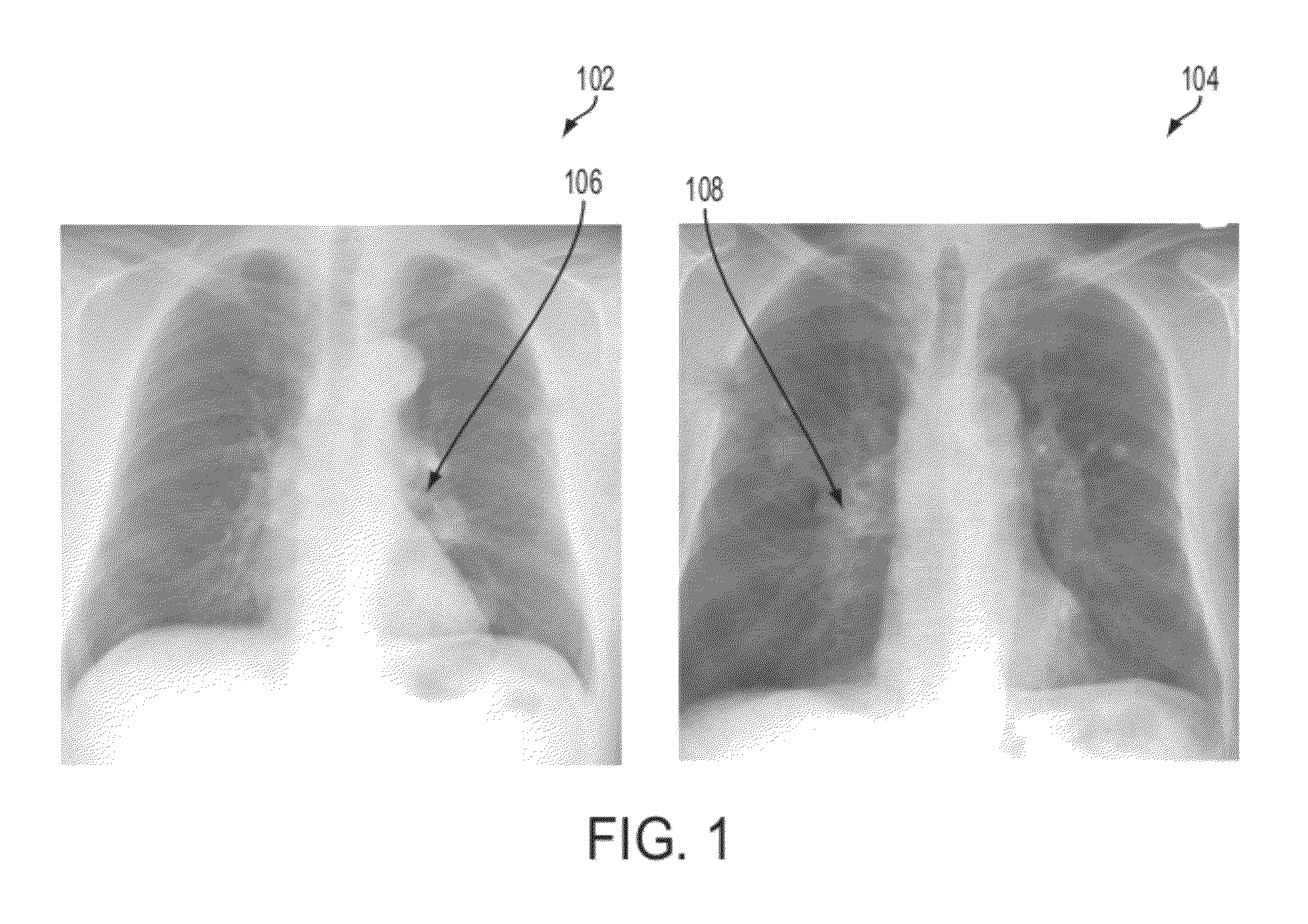 Method and system for nodule feature extraction using background contextual information in chest x-ray images