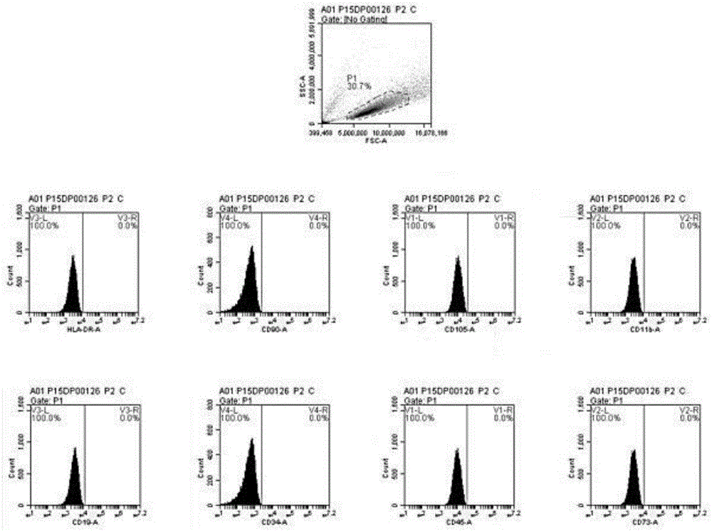 Stem cell exosome preparation as well as preparation method and application thereof