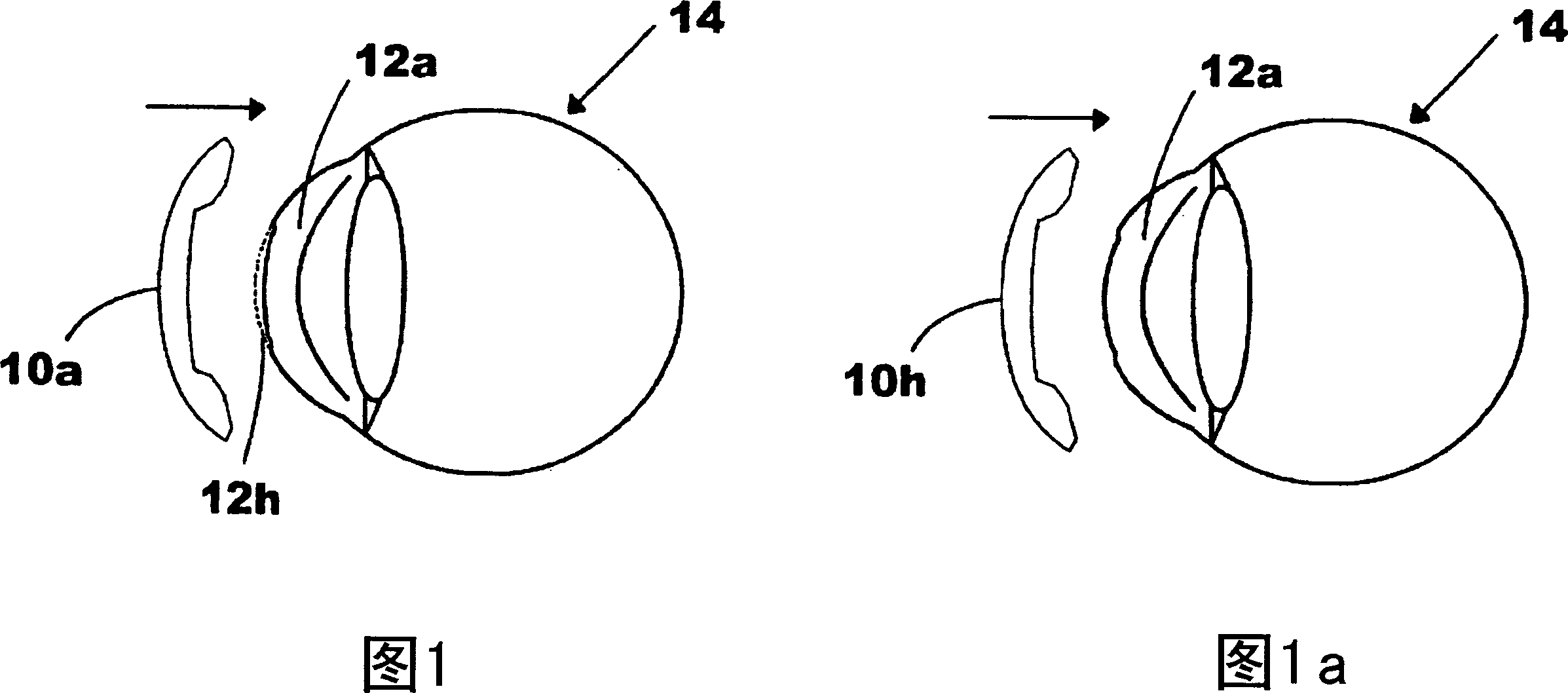 Contact lens for reshaping the altered corneas of post refractive surgery, post ortho-k or keratoconus