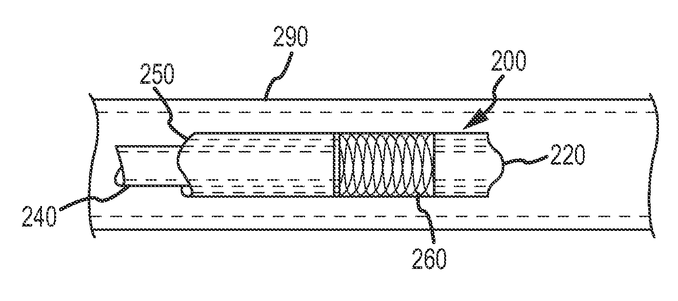 Devices and methods for treating venous diseases