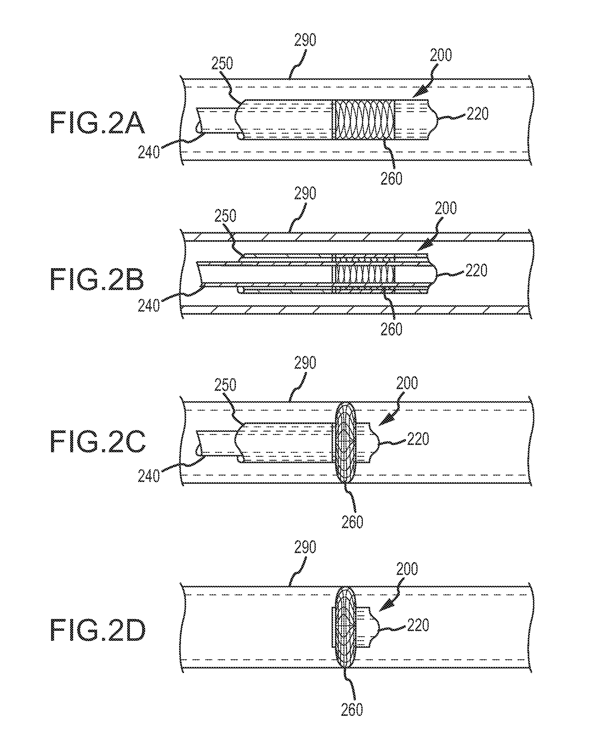 Devices and methods for treating venous diseases