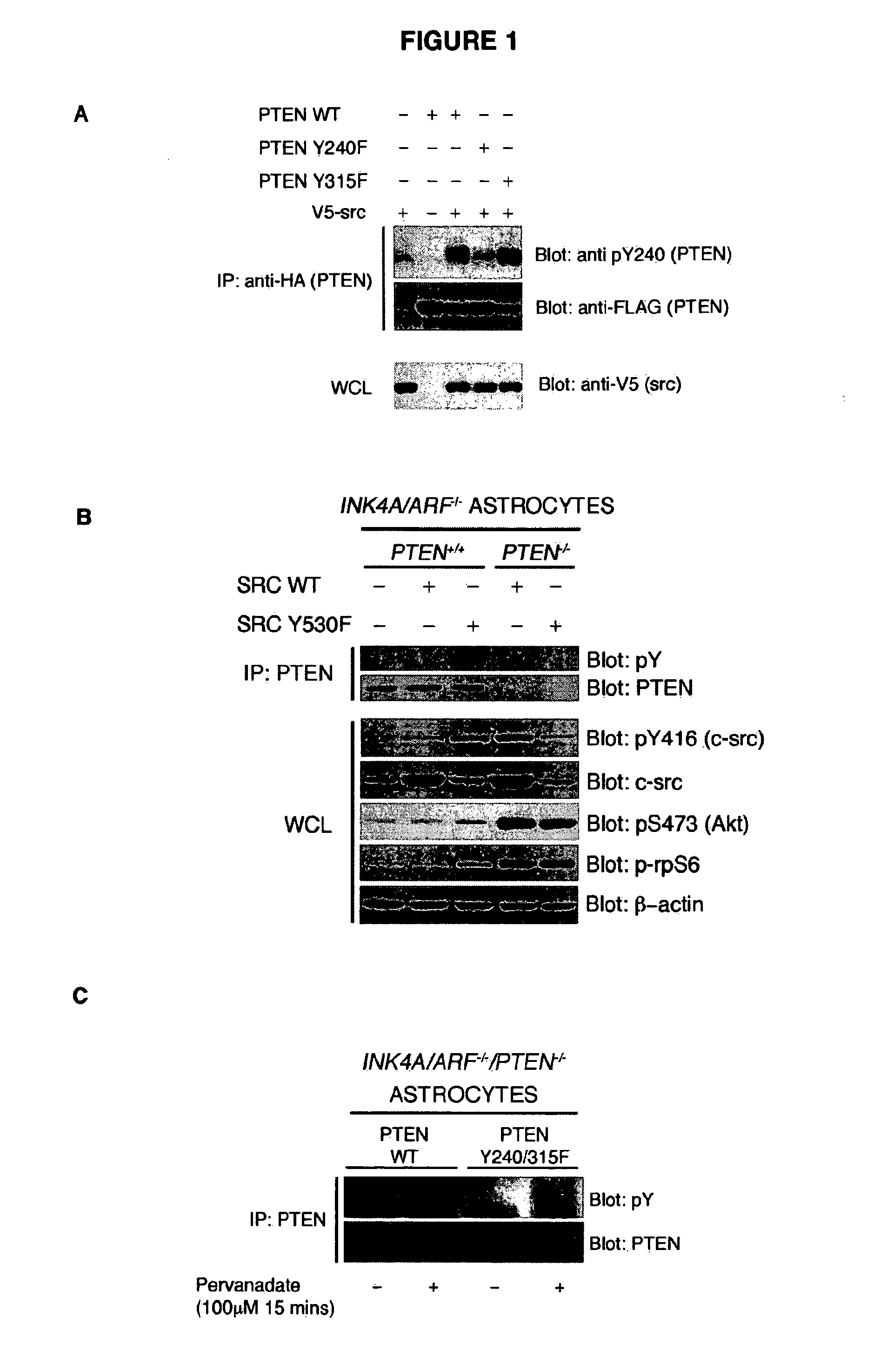 Pten phosphorylation-driven resistance to cancer treatment and altered patient prognosis