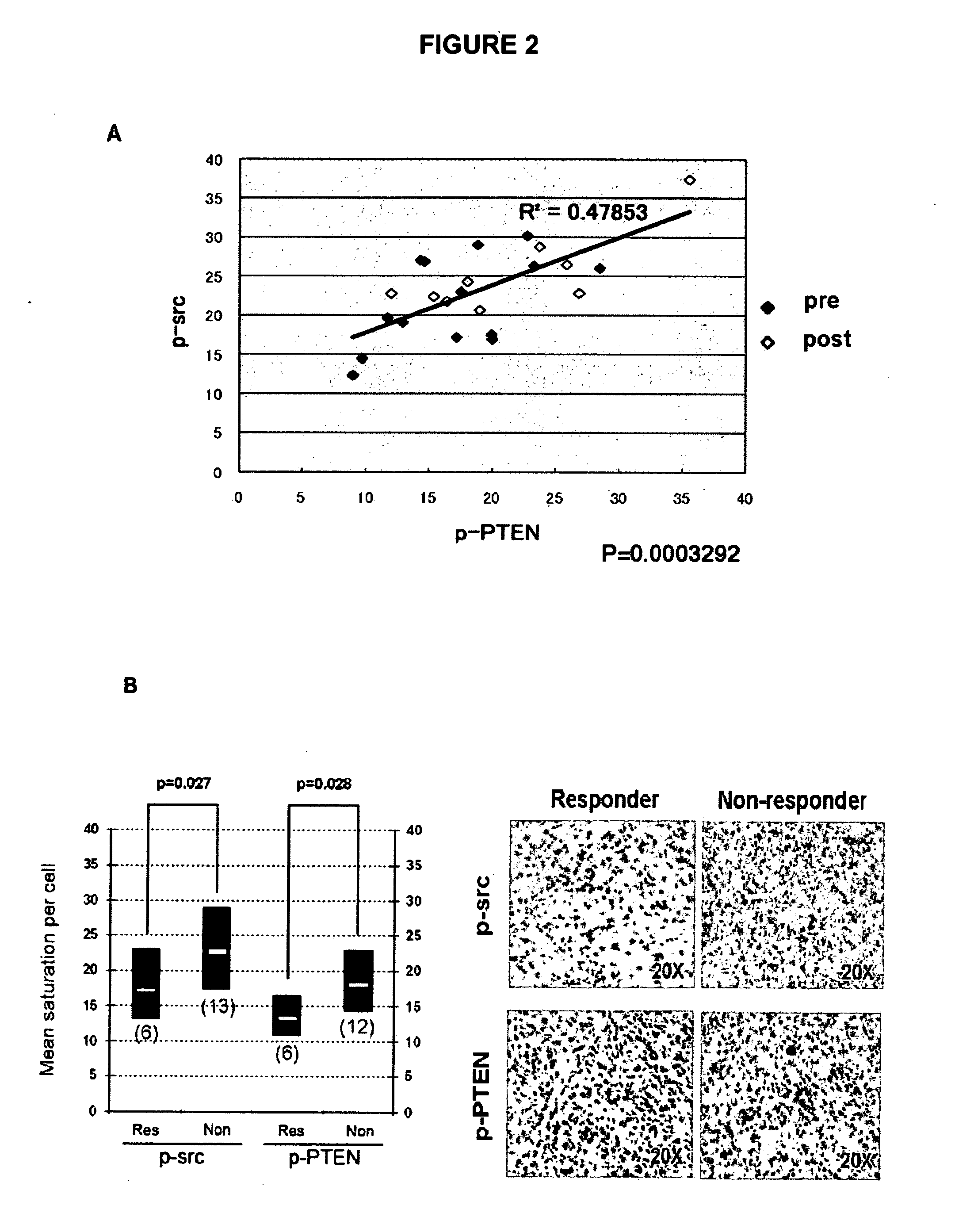 Pten phosphorylation-driven resistance to cancer treatment and altered patient prognosis