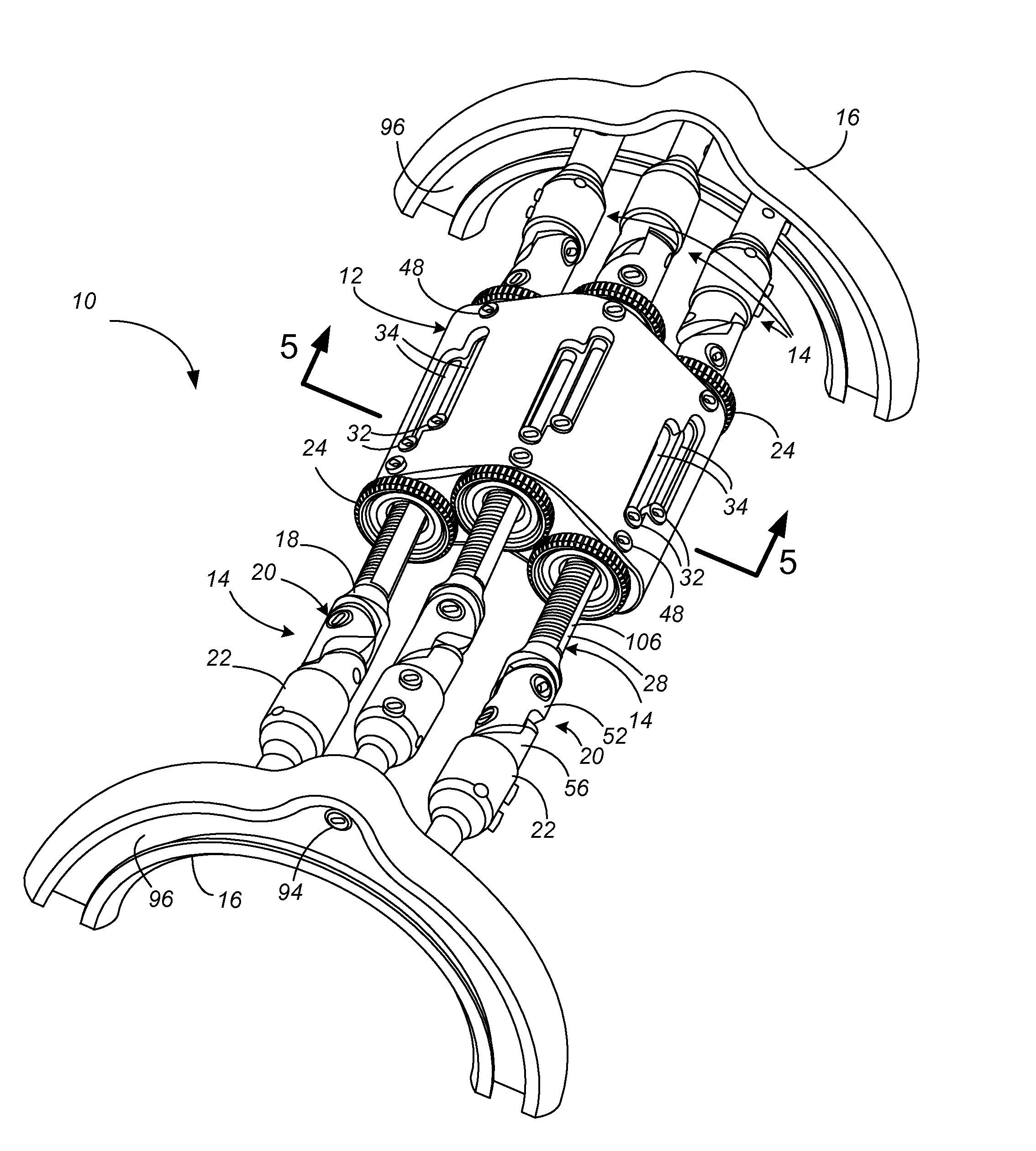 External Fixator