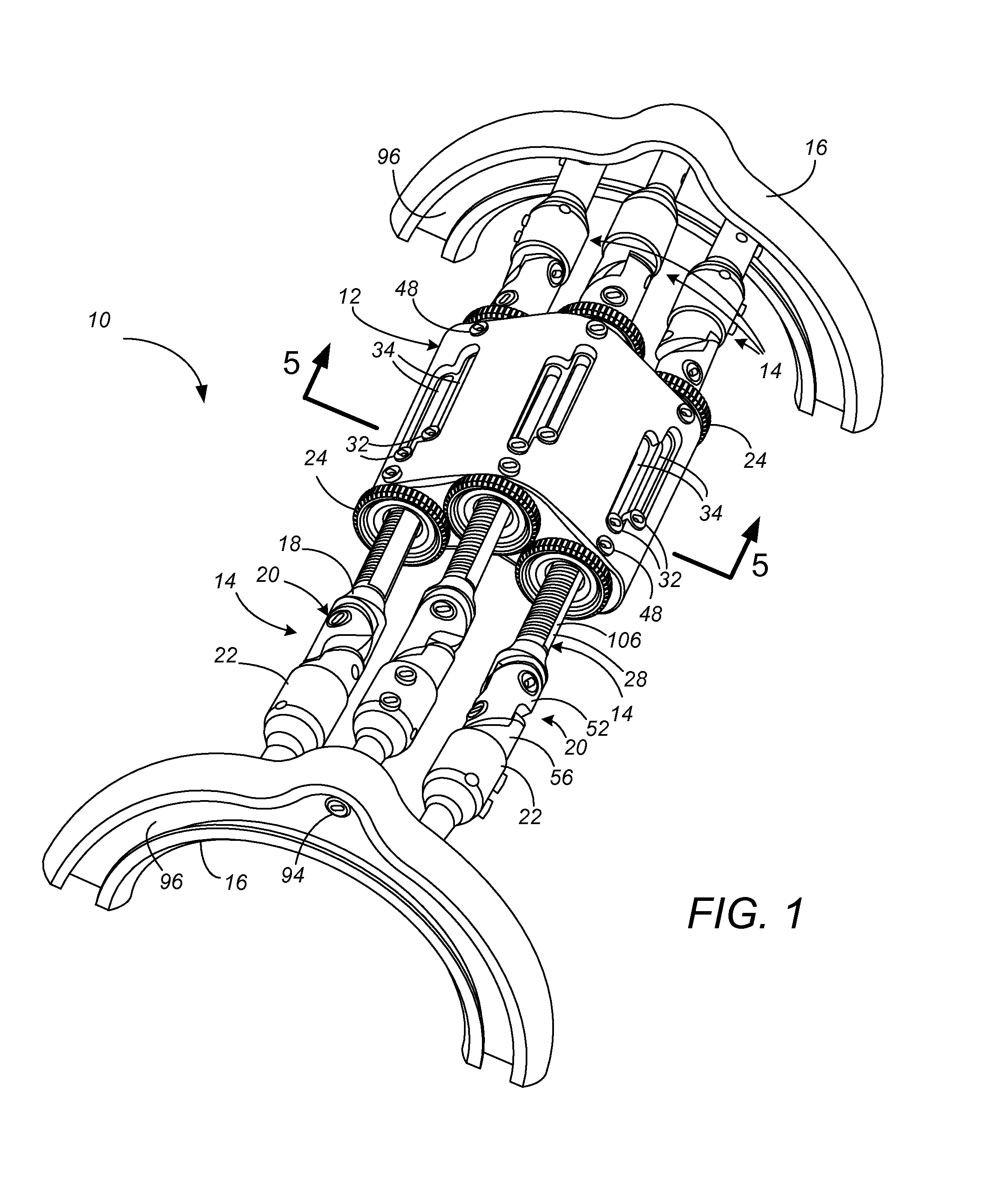 External Fixator