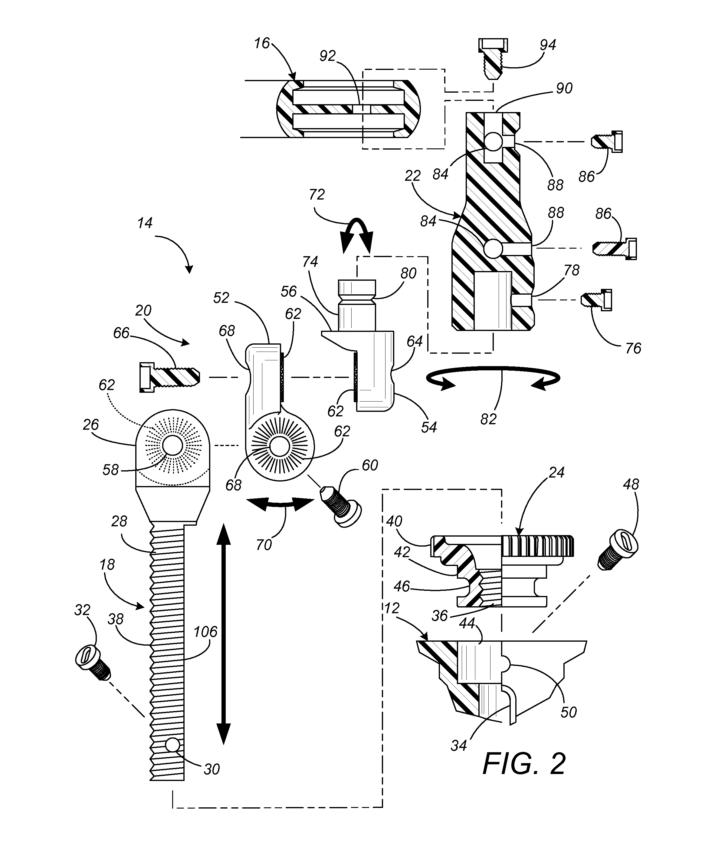 External Fixator