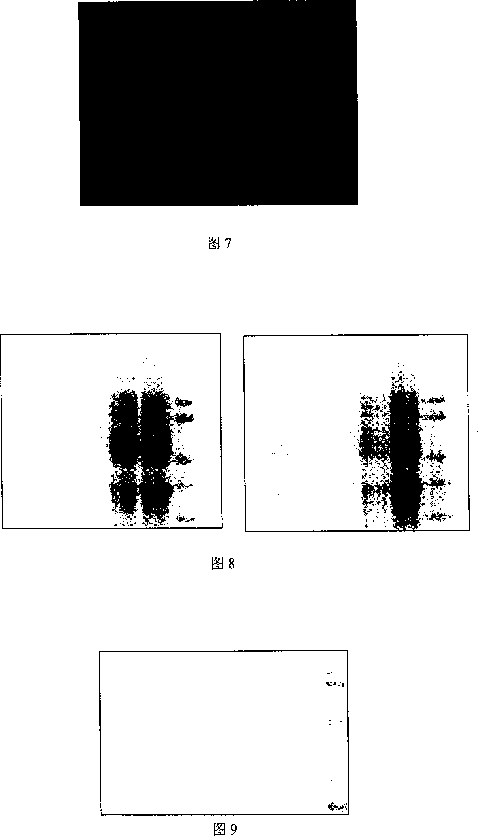 All-human source follicle stimulating hormone beta single-chain antibody screening method and its uses