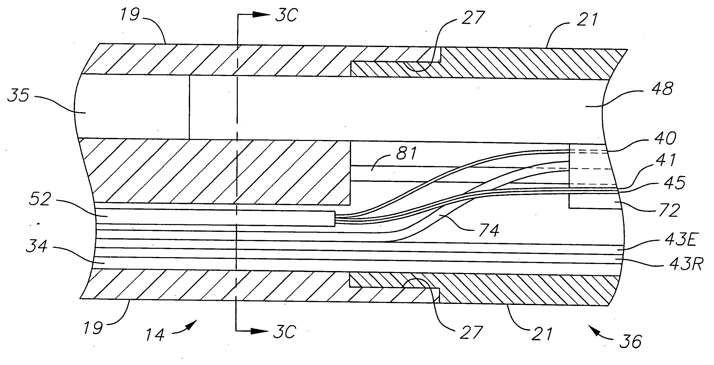 Catheter with omni-directional optical lesion evaluation