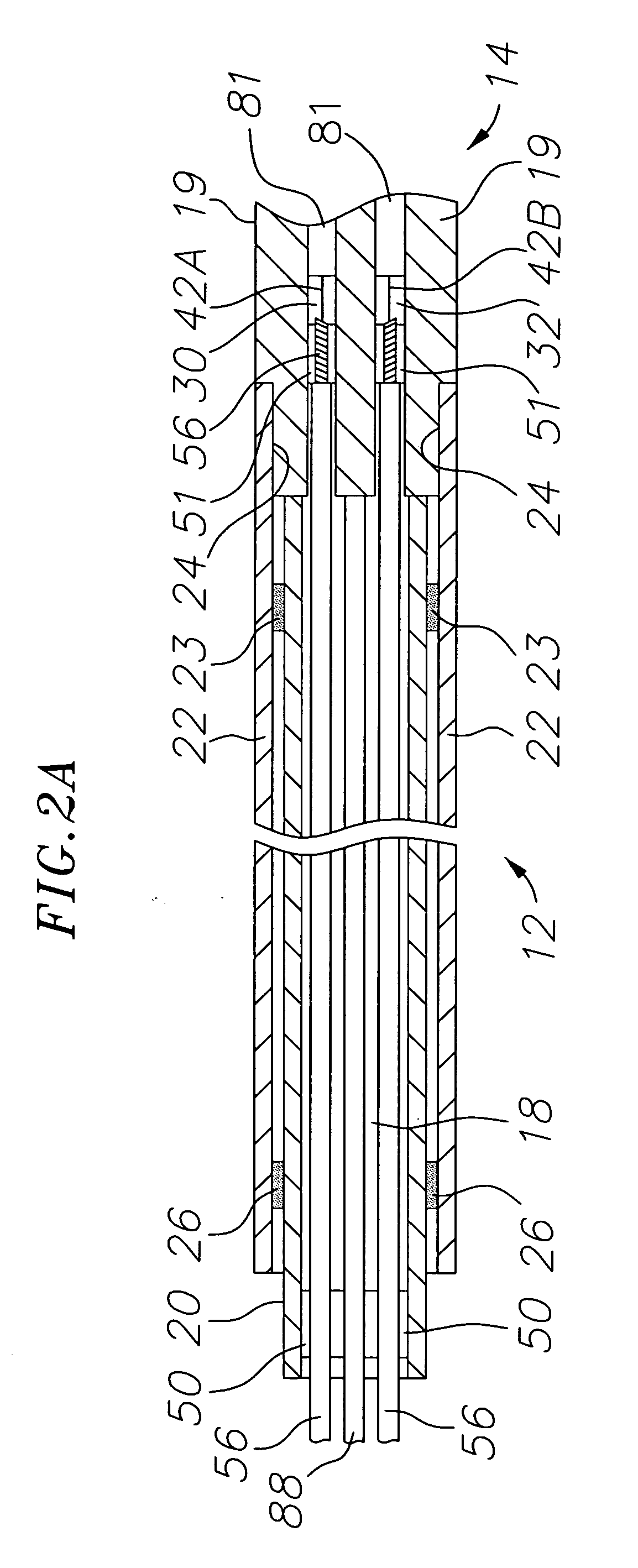 Catheter with omni-directional optical lesion evaluation