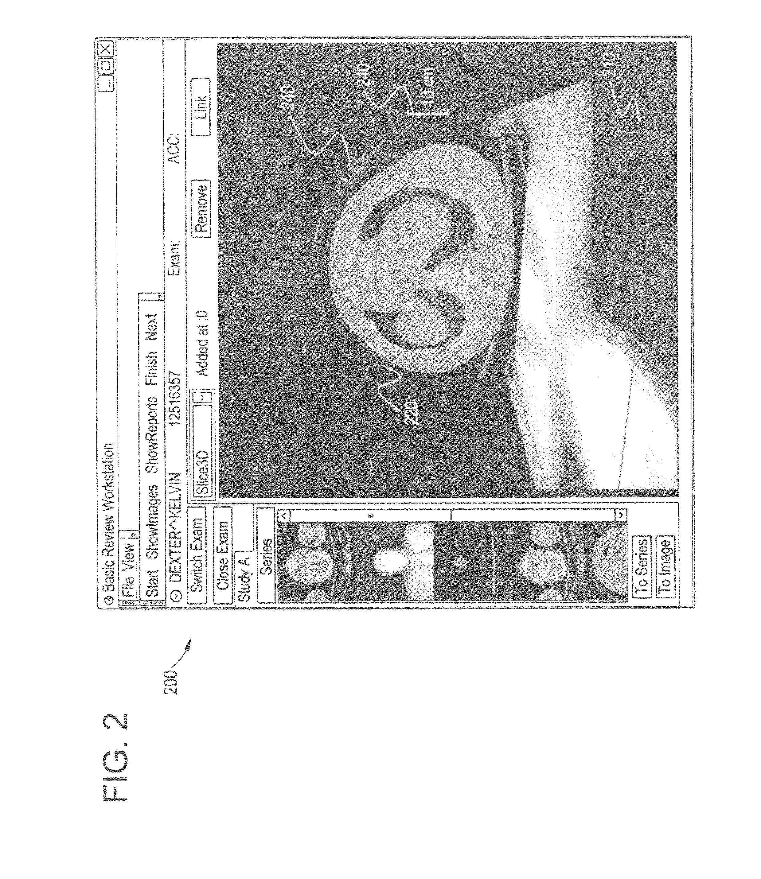 Systems and methods for image processing of 2D medical images