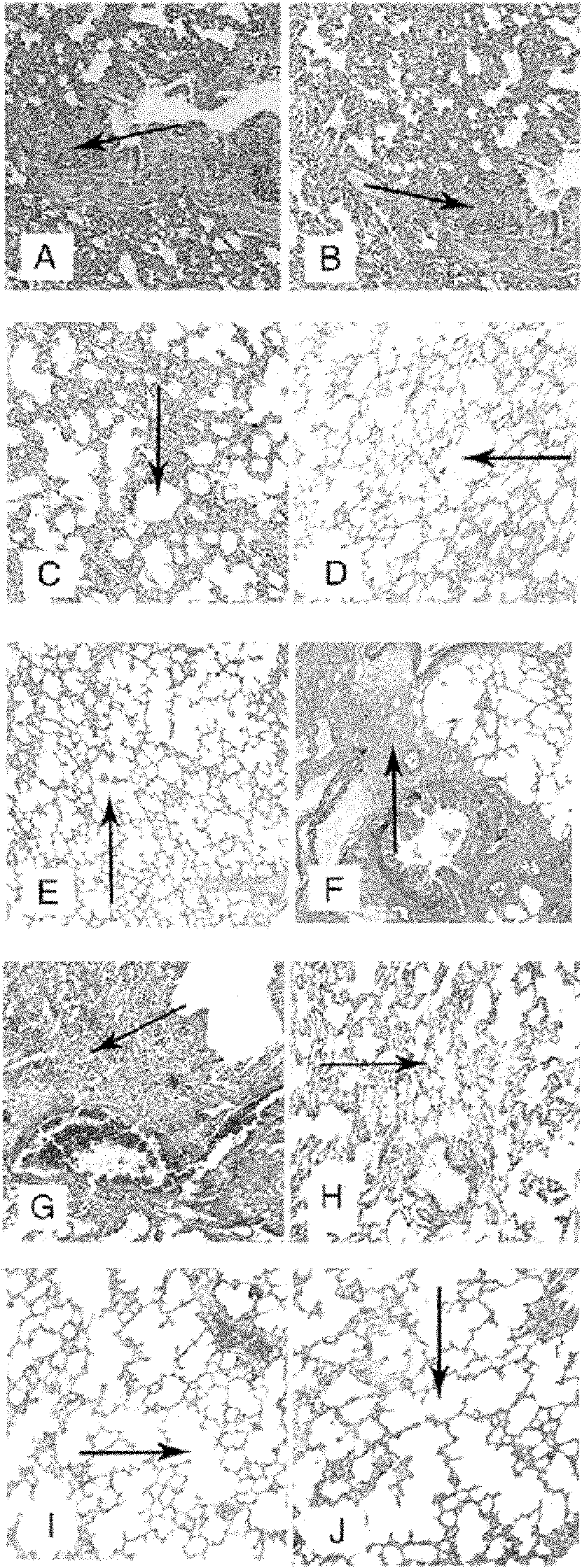 Quercetin hydroxypropyl Beta-cyclodextrin inclusion liposome, preparation method and application thereof