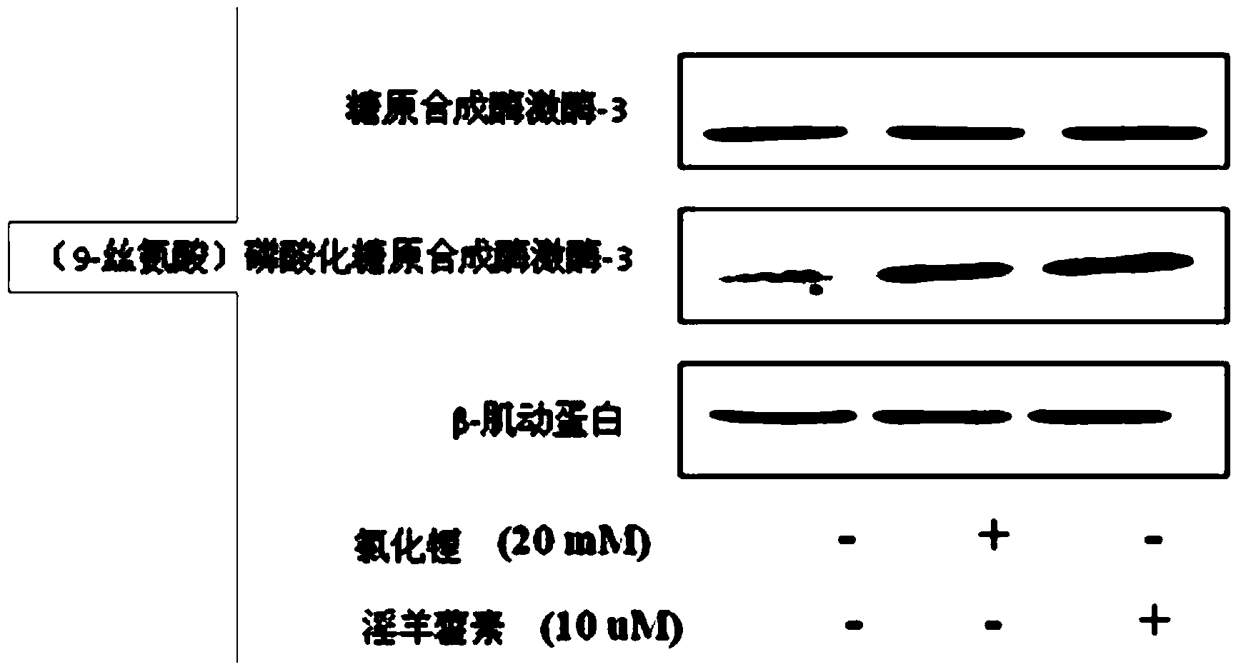 Applications of icaritin in preparing medicament for preventing and treating alzheimer disease