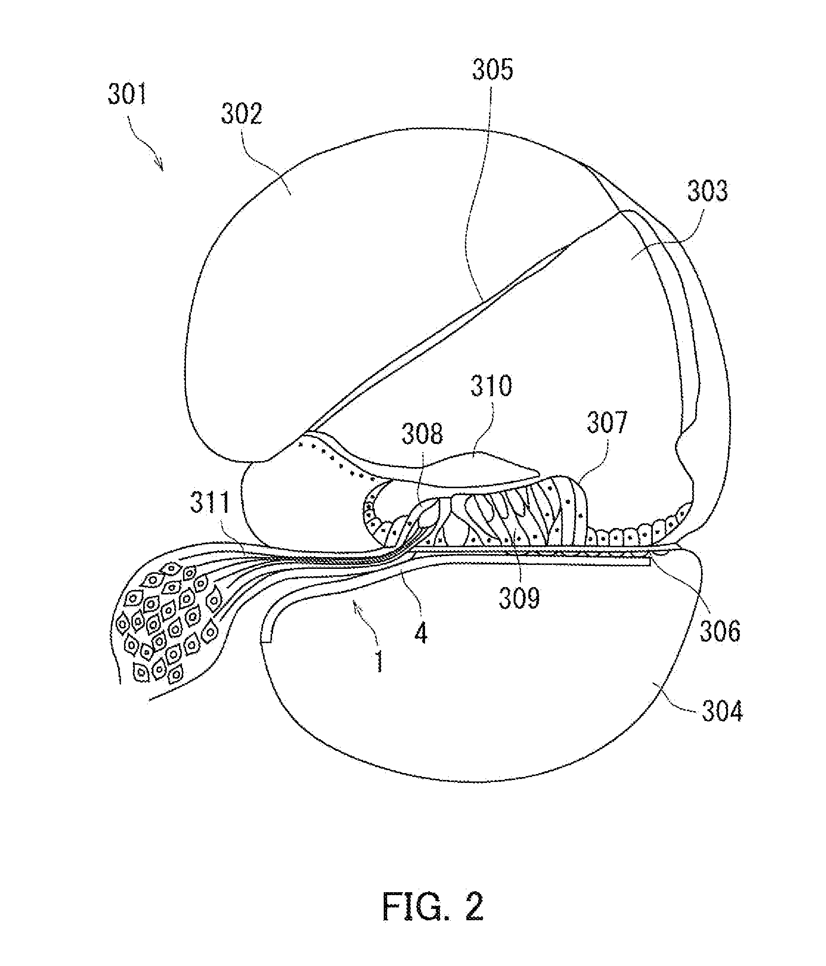 Artificial sensory epithelium