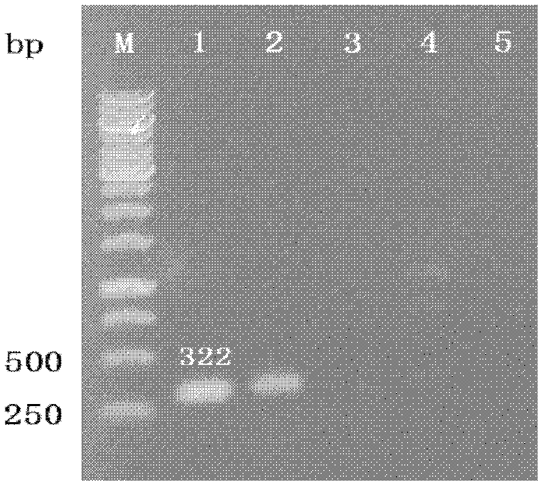 Specific pcr detection method of clubroot pathogen in soil