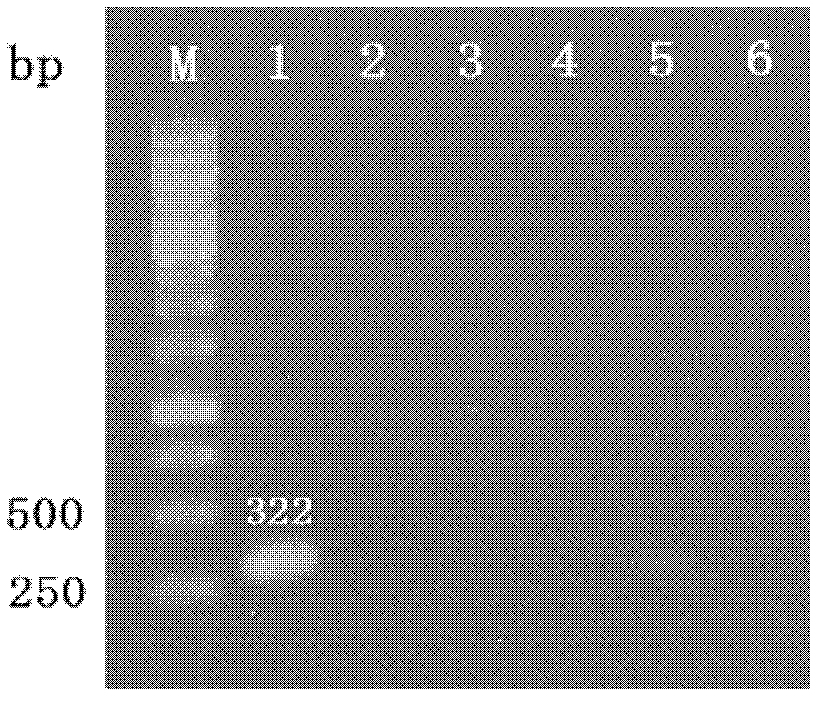 Specific pcr detection method of clubroot pathogen in soil