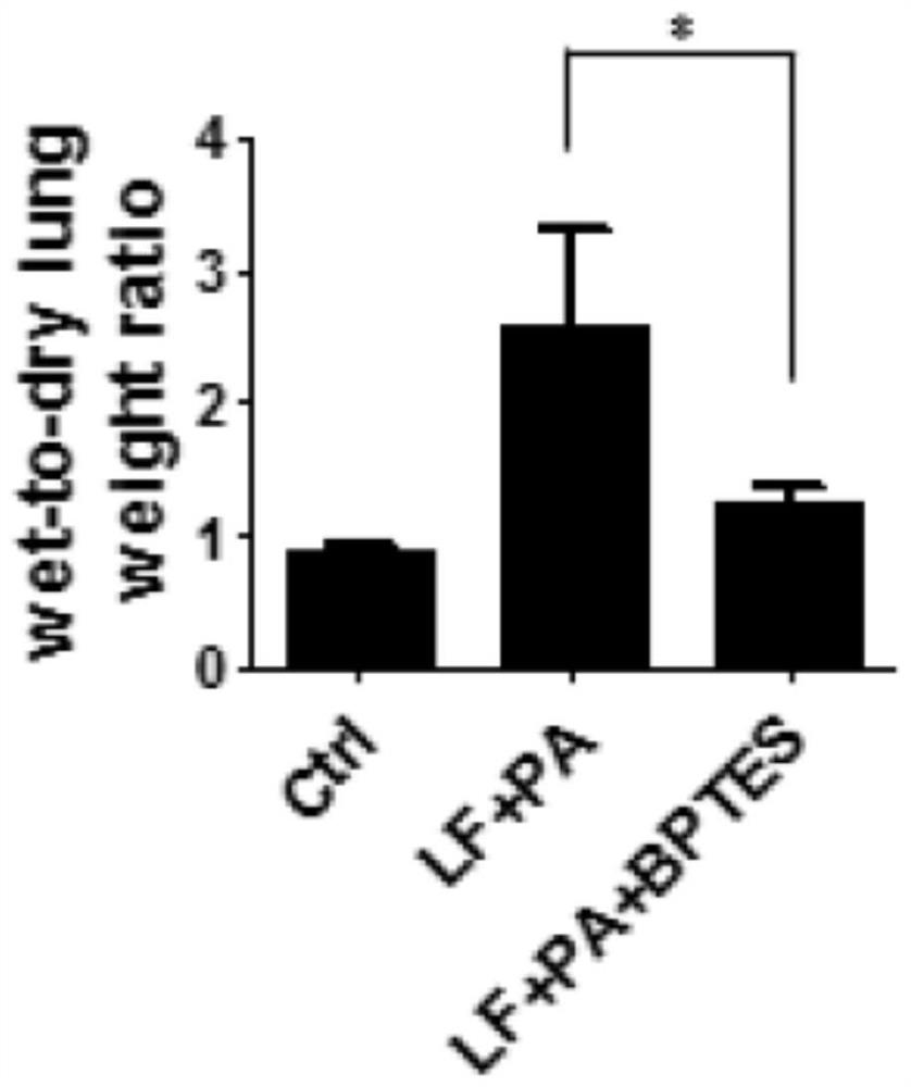 Application of BPTES in preparation of medicine for preventing or treating anthracnose