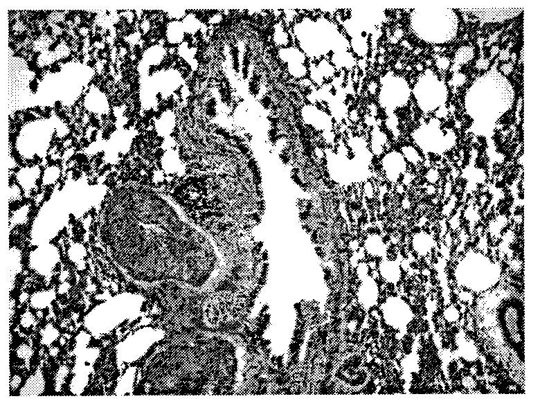 Crystalline pharmaceutical compound and preparation method and usage thereof