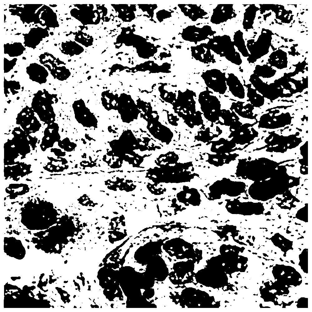 Immunohistochemical pathological image CD3 positive cell nucleus segmentation method and system