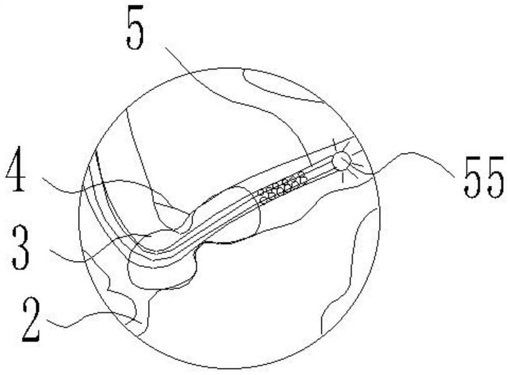 Device and method for preventing anastomotic fistula after colorectal surgery