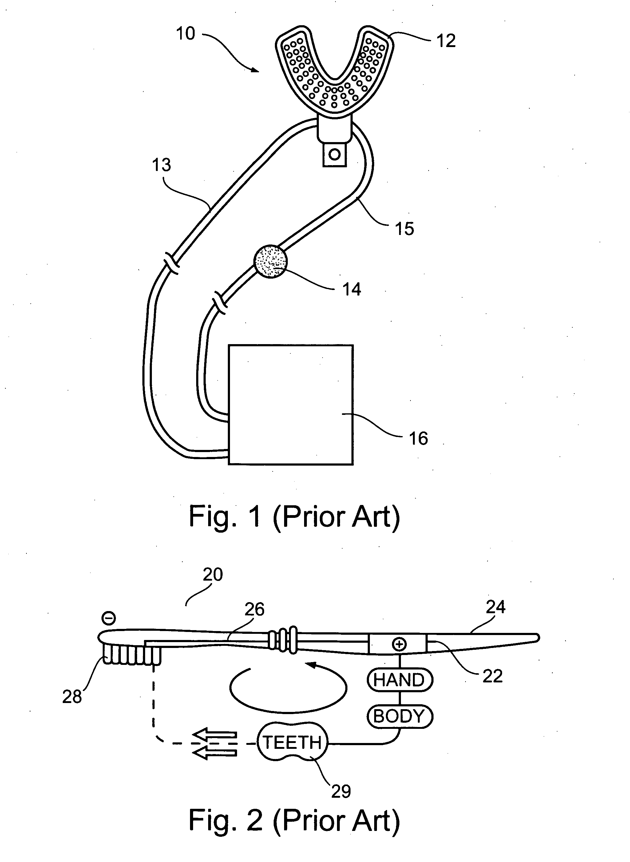 Electrochemically treating teeth